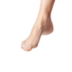 divaricatore infradito